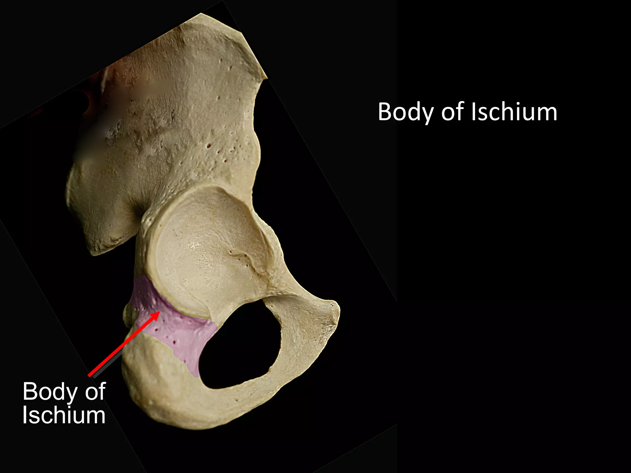 Body of
Ischium
Body of Ischium
 