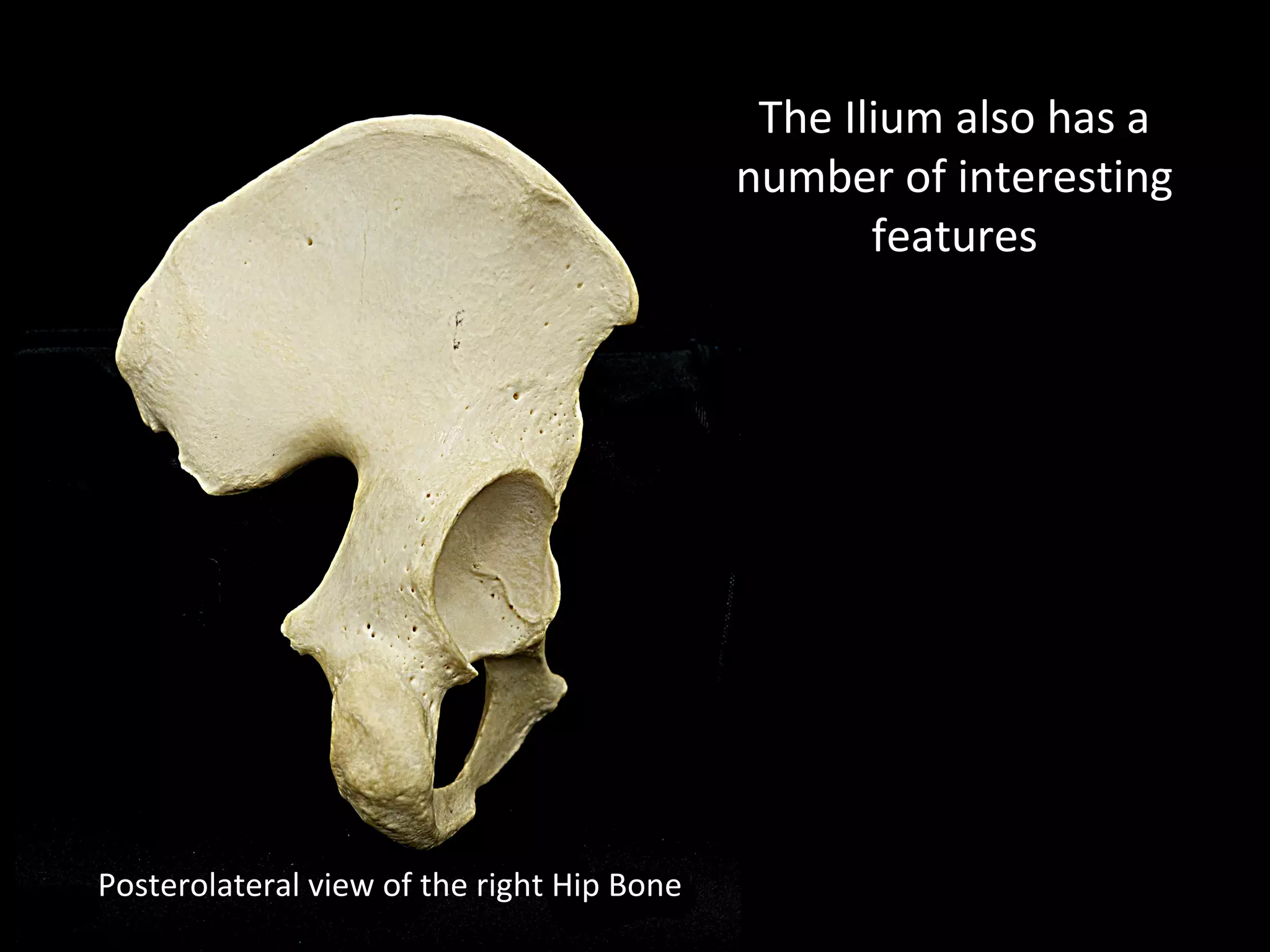 Posterolateral view of the right Hip Bone
The Ilium also has a
number of interesting
features
 