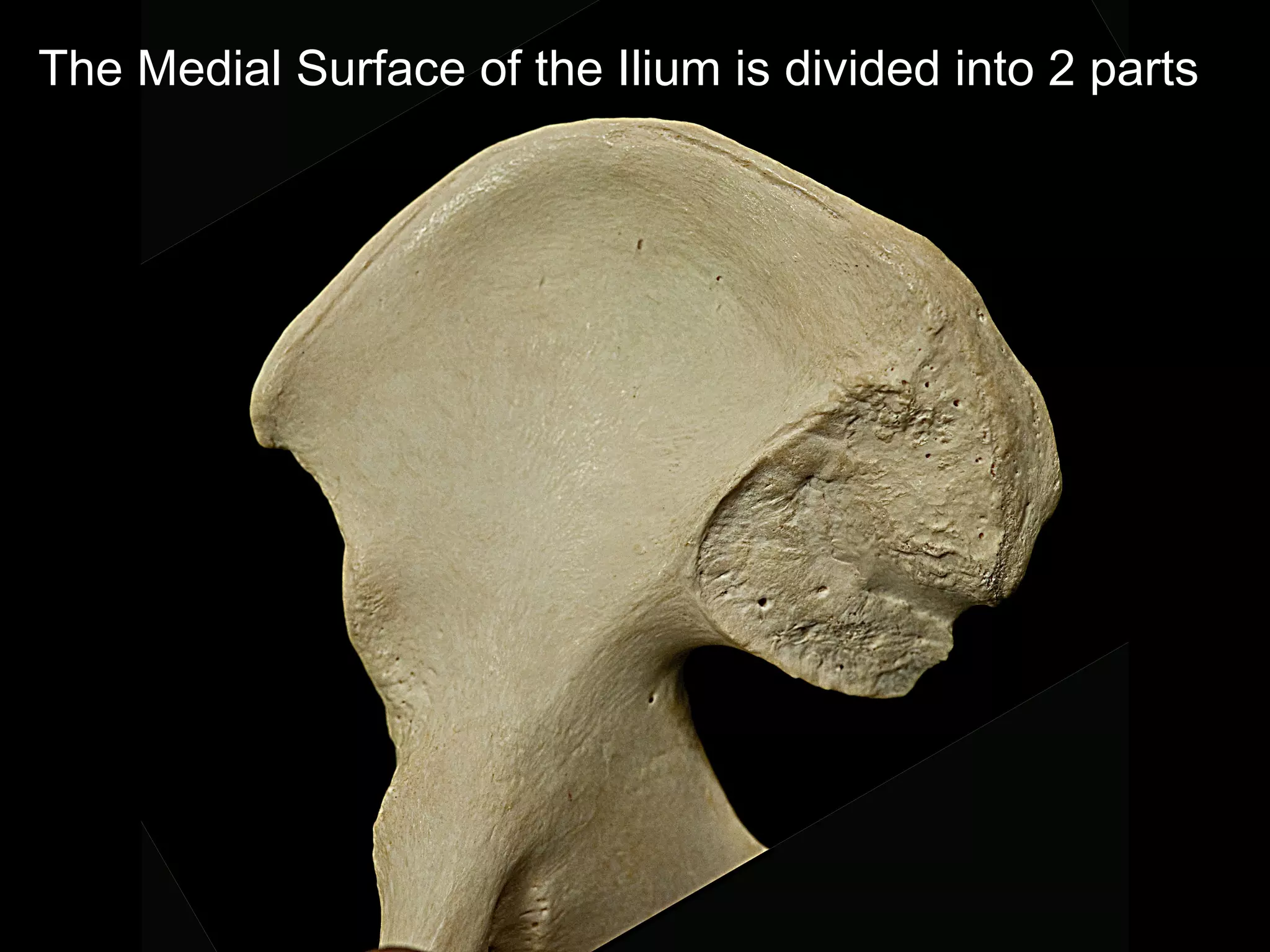 The Medial Surface of the Ilium is divided into 2 parts
 