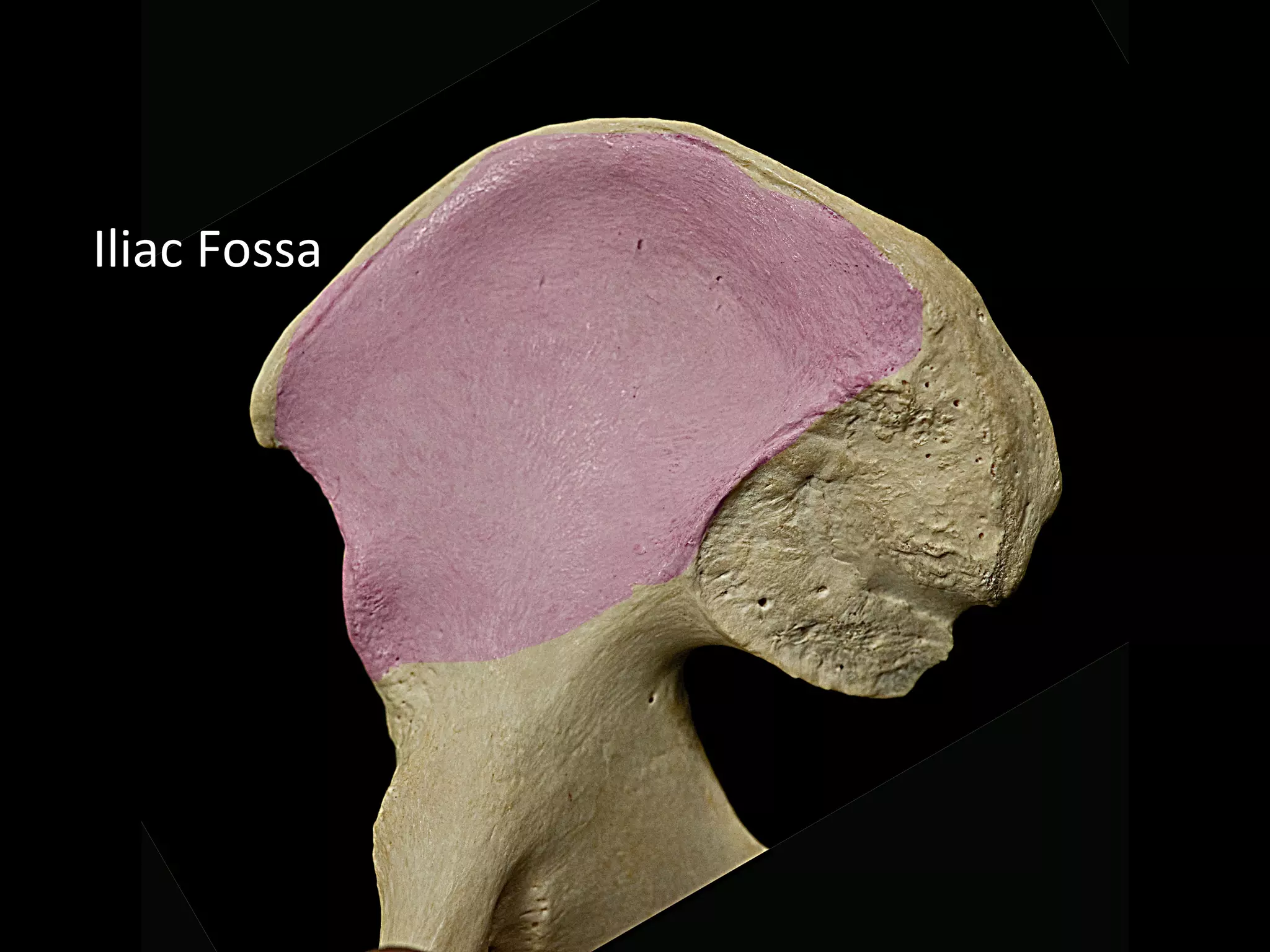 Iliac Fossa
 