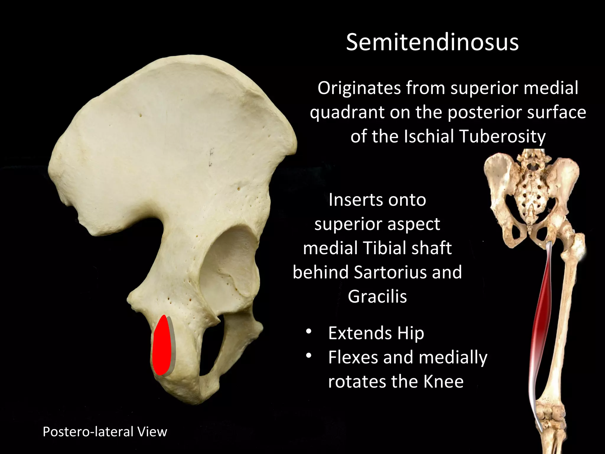 Postero-lateral View
Semitendinosus
Originates from superior medial
quadrant on the posterior surface
of the Ischial Tuberosity
Inserts onto
superior aspect
medial Tibial shaft
behind Sartorius and
Gracilis
• Extends Hip
• Flexes and medially
rotates the Knee
 