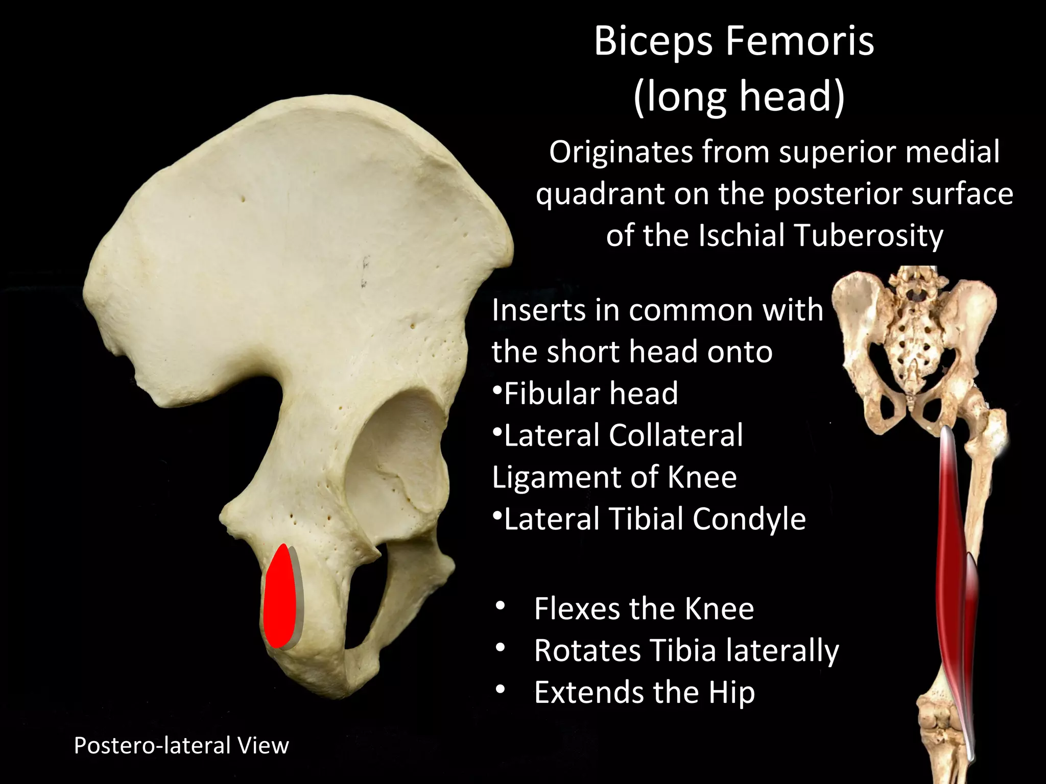 Postero-lateral View
Biceps Femoris
(long head)
Originates from superior medial
quadrant on the posterior surface
of the Ischial Tuberosity
Inserts in common with
the short head onto
•Fibular head
•Lateral Collateral
Ligament of Knee
•Lateral Tibial Condyle
• Flexes the Knee
• Rotates Tibia laterally
• Extends the Hip
 