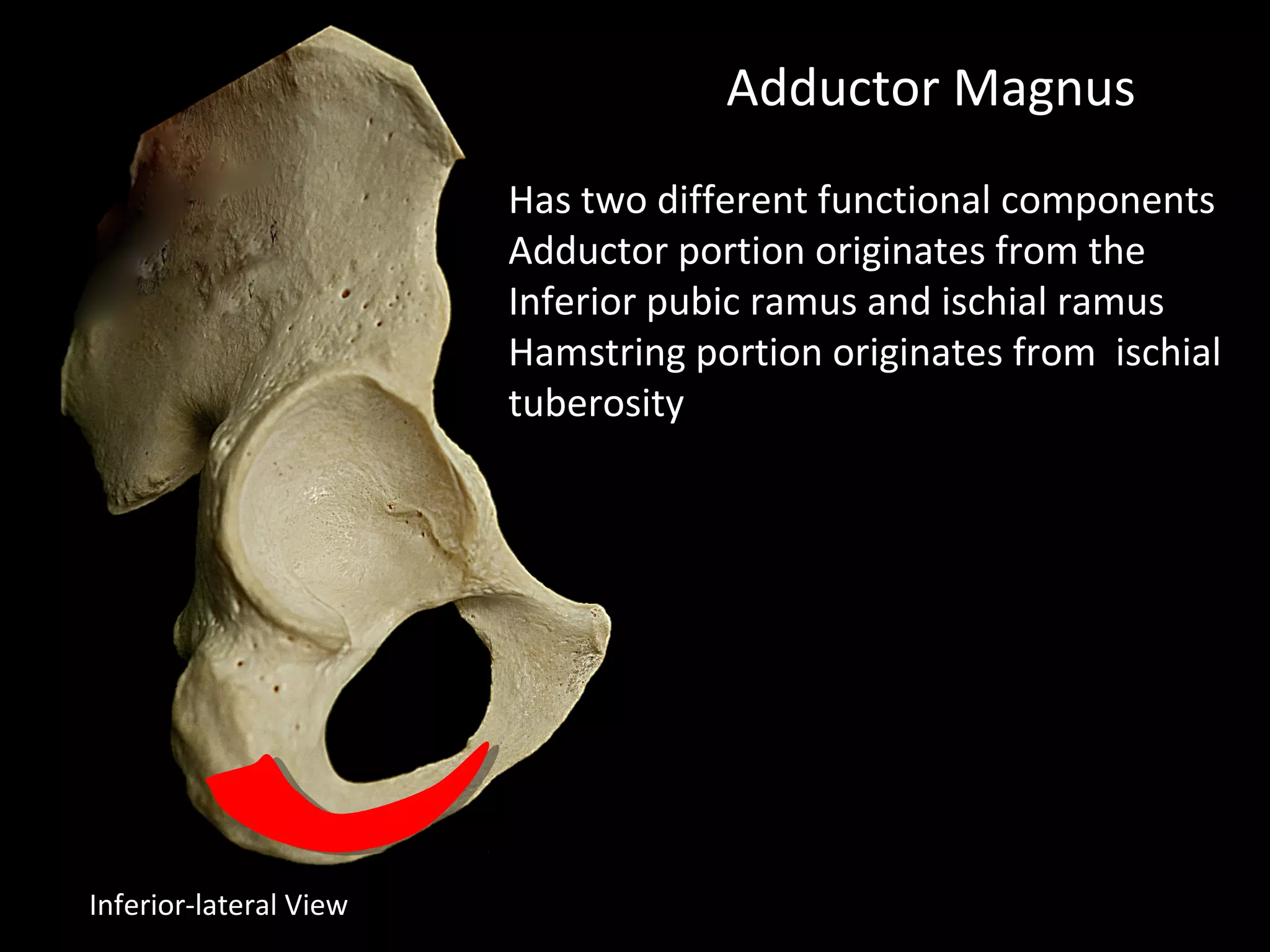Adductor Magnus
Has two different functional components
Adductor portion originates from the
Inferior pubic ramus and ischial ramus
Hamstring portion originates from ischial
tuberosity
Inferior-lateral View
 