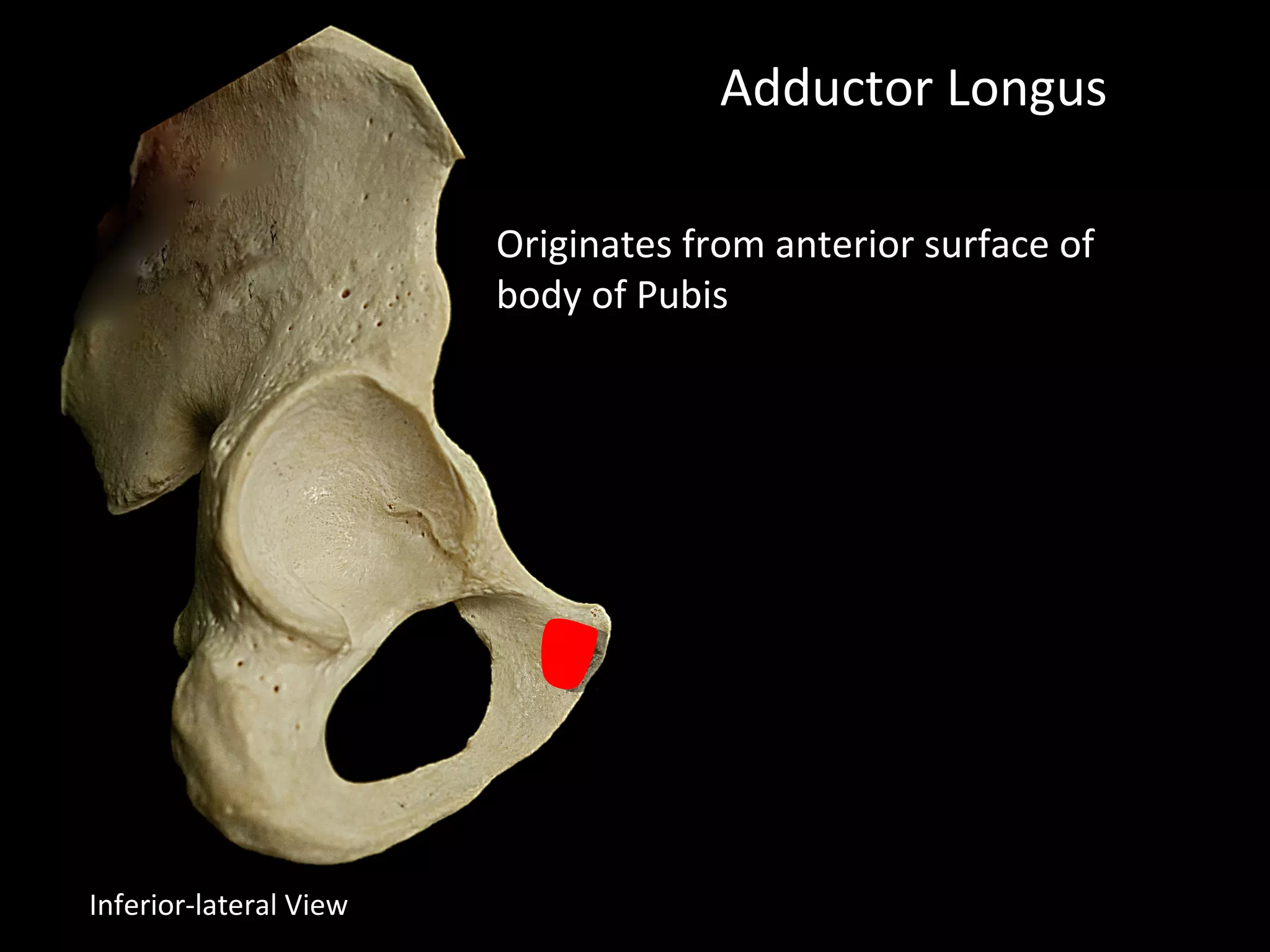 Adductor Longus
Originates from anterior surface of
body of Pubis
Inferior-lateral View
 