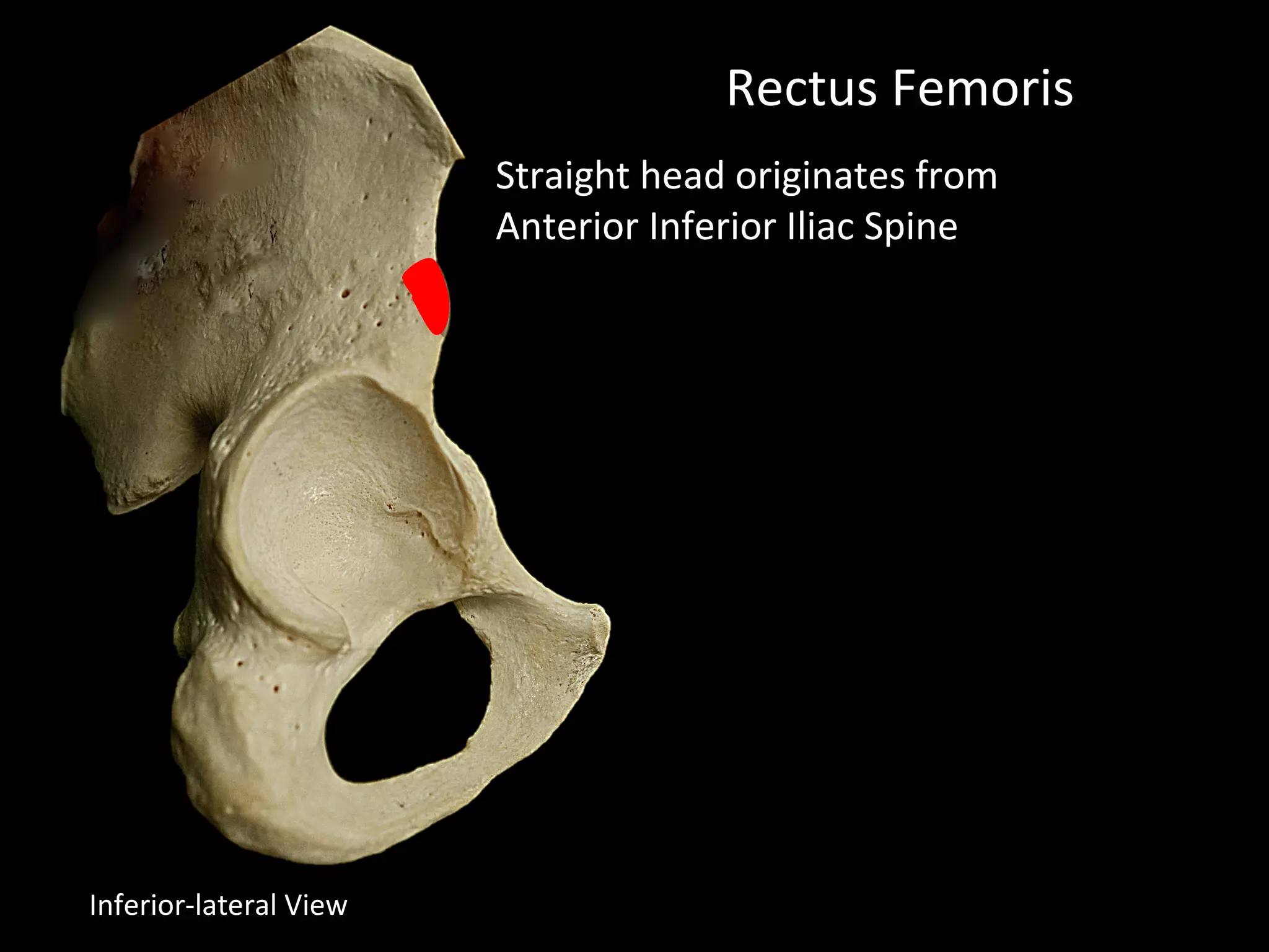Rectus Femoris
Straight head originates from
Anterior Inferior Iliac Spine
Inferior-lateral View
 