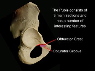 The Pubis consists of
3 main sections and
has a number of
interesting features
Obturator Crest
Obturator Groove
 