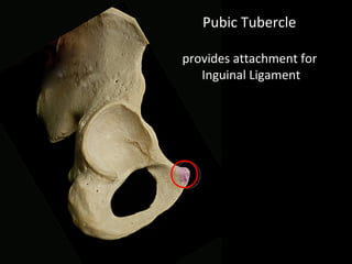 Pubic Tubercle
provides attachment for
Inguinal Ligament
 