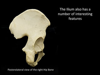 Posterolateral view of the right Hip Bone
The Ilium also has a
number of interesting
features
 