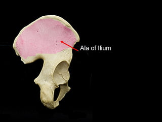 Ala of Ilium
 