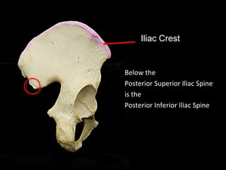 Iliac Crest
Below the
Posterior Superior Iliac Spine
is the
Posterior Inferior Iliac Spine
 