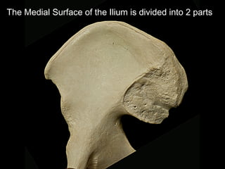 The Medial Surface of the Ilium is divided into 2 parts
 