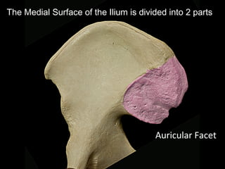 The Medial Surface of the Ilium is divided into 2 parts
Auricular Facet
 