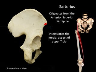 Postero-lateral View
Sartorius
Originates from the
Anterior Superior
Iliac Spine
Inserts onto the
medial aspect of
upper Tibia
 