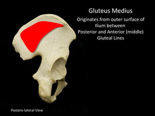 Postero-lateral View
Gluteus Medius
Originates from outer surface of
Ilium between
Posterior and Anterior (middle)
Gluteal Lines
 