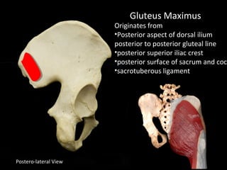 Postero-lateral View
Gluteus Maximus
Originates from
•Posterior aspect of dorsal ilium
posterior to posterior gluteal line
•posterior superior iliac crest
•posterior surface of sacrum and cocc
•sacrotuberous ligament
 