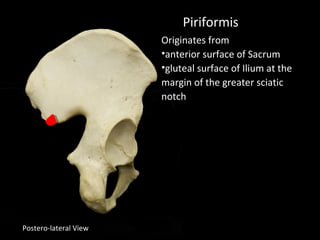Postero-lateral View
Piriformis
Originates from
•anterior surface of Sacrum
•gluteal surface of Ilium at the
margin of the greater sciatic
notch
 
