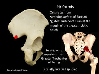 Postero-lateral View
Piriformis
Originates from
•anterior surface of Sacrum
•gluteal surface of Ilium at the
margin of the greater sciatic
notch
Inserts onto
superior aspect
Greater Trochanter
of Femur
Laterally rotates Hip Joint
 