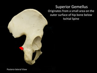 Postero-lateral View
Superior Gemellus
Originates from a small area on the
outer surface of hip bone below
Ischial Spine
 