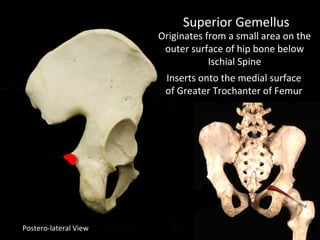 Postero-lateral View
Superior Gemellus
Originates from a small area on the
outer surface of hip bone below
Ischial Spine
Inserts onto the medial surface
of Greater Trochanter of Femur
 