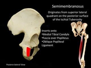 Postero-lateral View
Semimembranosus
Originates from superior lateral
quadrant on the posterior surface
of the Ischial Tuberosity
Inserts onto
•Medial Tibial Condyle
•Fascia over Popliteus
•Oblique Popliteal
Ligament
 