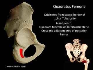 Quadratus Femoris
Originates from lateral border of
Ischial Tuberosity
Inferior-lateral View
Inserts onto
Quadrate tubercle on Intertrochanteric
Crest and adjacent area of posterior
Femur
 