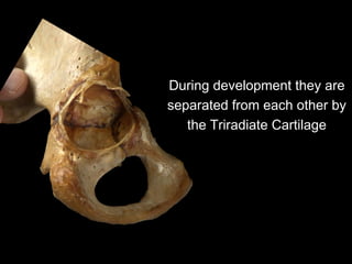 During development they are
separated from each other by
the Triradiate Cartilage
 