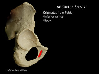 Adductor Brevis
Originates from Pubis
•Inferior ramus
•Body
Inferior-lateral View
 