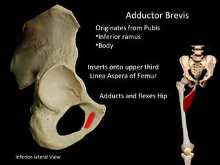 Adductor Brevis
Originates from Pubis
•Inferior ramus
•Body
Inserts onto upper third
Linea Aspera of Femur
Adducts and flexes Hip
Inferior-lateral View
 
