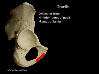 Gracilis
Originates from
•Inferior ramus of pubis
•Ramus of ischium
Inferior-lateral View
 