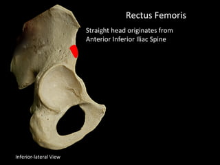 Rectus Femoris
Straight head originates from
Anterior Inferior Iliac Spine
Inferior-lateral View
 