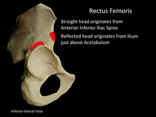 Rectus Femoris
Straight head originates from
Anterior Inferior Iliac Spine
Reflected head originates from Ilium
just above Acetabulum
Inferior-lateral View
 