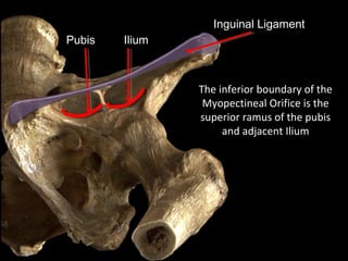 Pubis
The inferior boundary of the
Myopectineal Orifice is the
superior ramus of the pubis
and adjacent Ilium
Inguinal Ligament
Ilium
 