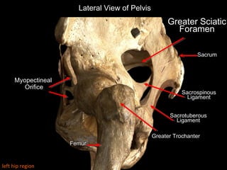 Greater SciaticGreater Sciatic
ForamenForamen
Lateral View of Pelvis
SacrumSacrum
FemurFemur
Greater TrochanterGreater Trochanter
Myopectineal
Orifice
SacrospinousSacrospinous
LigamentLigament
SacrotuberousSacrotuberous
LigamentLigament
left hip region
 