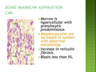  Marrow is
hypercellular with
granulocytic
predominance.
 Megakaryocytes are
increased in number
with abnormal
morphology.
 Increase in reticulin
fibrosis.
 Blasts less than 5%.
 
