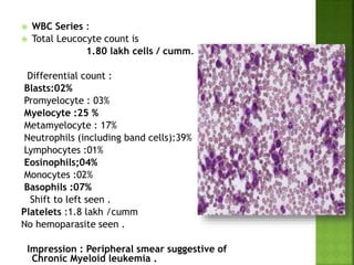  WBC Series :
 Total Leucocyte count is
1.80 lakh cells / cumm.
Differential count :
Blasts:02%
Promyelocyte : 03%
Myelocyte :25 %
Metamyelocyte : 17%
Neutrophils (including band cells):39%
Lymphocytes :01%
Eosinophils;04%
Monocytes :02%
Basophils :07%
Shift to left seen .
Platelets :1.8 lakh /cumm
No hemoparasite seen .
Impression : Peripheral smear suggestive of
Chronic Myeloid leukemia .
 