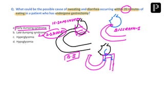 a. Early dumping syndrome
b. Late dumping syndrome
c. Hyperglycemia
d. Hypoglycemia
Q. What could be the possible cause of sweating and diarrhea occurring within 20 minutes of
eating in a patient who has undergone gastrectomy?
 