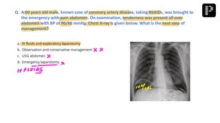 a. IV fluids and exploratory laparotomy
b. Observation and conservative management
c. USG abdomen
d. Emergency laparotomy
Q. A 60 years old male, known case of coronary artery disease, taking NSAIDs, was brought to
the emergency with pain abdomen. On examination, tenderness was present all over
abdomen with BP of 90/60 mmHg. Chest X-ray is given below. What is the next step of
management?
 