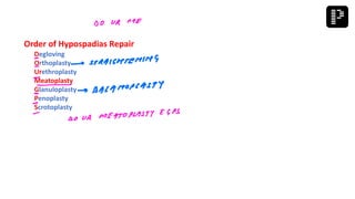 Order of Hypospadias Repair
Degloving
Orthoplasty
Urethroplasty
Meatoplasty
Glanuloplasty
Penoplasty
Scrotoplasty
 