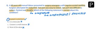 a. Content is omentum
b. It is enterocele
c. Content is small intestine
d. None of the above
Q. A 40 years old manual labour presented to surgery emergency with inguino-scrotal swelling.
Surgeon attempted the reduction, first part was easy to reduce, last part was difficult to
reduce. Content was doughy. Which of the following statement is correct about this
condition?
 