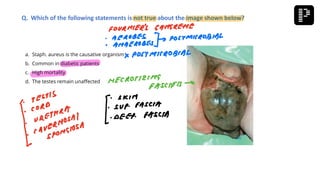 a. Staph. aureus is the causative organism
b. Common in diabetic patients
c. High mortality
d. The testes remain unaffected
Q. Which of the following statements is not true about the image shown below?
 