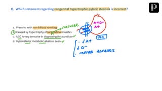 a. Presents with non-bilious vomiting
b. Caused by hypertrophy of longitudinal muscles
c. USG is very sensitive in diagnosing this condition
d. Hypokalemic metabolic alkalosis seen
Q. Which statement regarding congenital hypertrophic pyloric stenosis is incorrect?
 