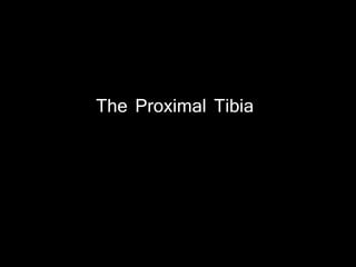 The Proximal Tibia
 