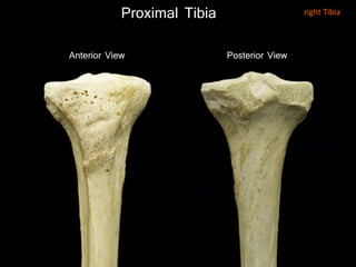 Proximal Tibia
Anterior View Posterior View
right Tibia
 