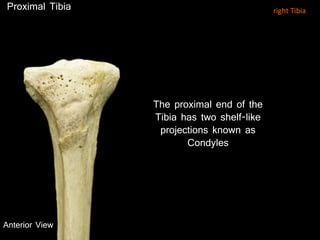 The proximal end of the
Tibia has two shelf-like
projections known as
Condyles
Anterior View
Proximal Tibia right Tibia
 
