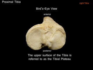 The upper surface of the Tibia is
referred to as the Tibial Plateau
Bird’s-Eye View
posterior
anterior
Proximal Tibia right Tibia
 