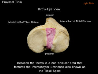 Bird’s-Eye View
posterior
anterior
Proximal Tibia
Between the facets is a non-articular area that
features the Intercondylar Eminence also known as
the Tibial Spine
right Tibia
Lateral half of Tibial PlateauMedial half of Tibial Plateau
 