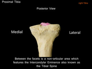 Between the facets is a non-articular area which
features the Intercondylar Eminence also known as
the Tibial Spine
Posterior View
Proximal Tibia
LateralMedial
right Tibia
 