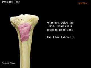 Anteriorly, below the
Tibial Plateau is a
prominence of bone
The Tibial Tuberosity
Proximal Tibia
Anterior View
right Tibia
 