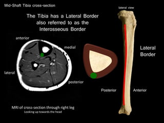 Anterior
Mid-Shaft Tibia cross-section
Posterior
Lateral
Border
lateral view
MRI of cross-section through right leg
Looking up towards the head
anterior
posterior
medial
lateral
The Tibia has a Lateral Border
also referred to as the
Interosseous Border
 