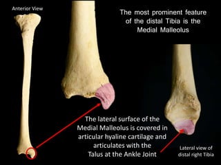 The most prominent feature
of the distal Tibia is the
Medial Malleolus
Anterior View
The lateral surface of the
Medial Malleolus is covered in
articular hyaline cartilage and
articulates with the
Talus at the Ankle Joint
Lateral view of
distal right Tibia
 